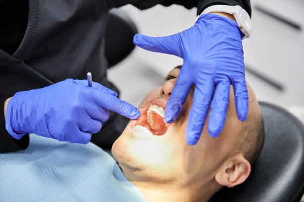 Best Emergency Tooth Extraction in Terry, MS
